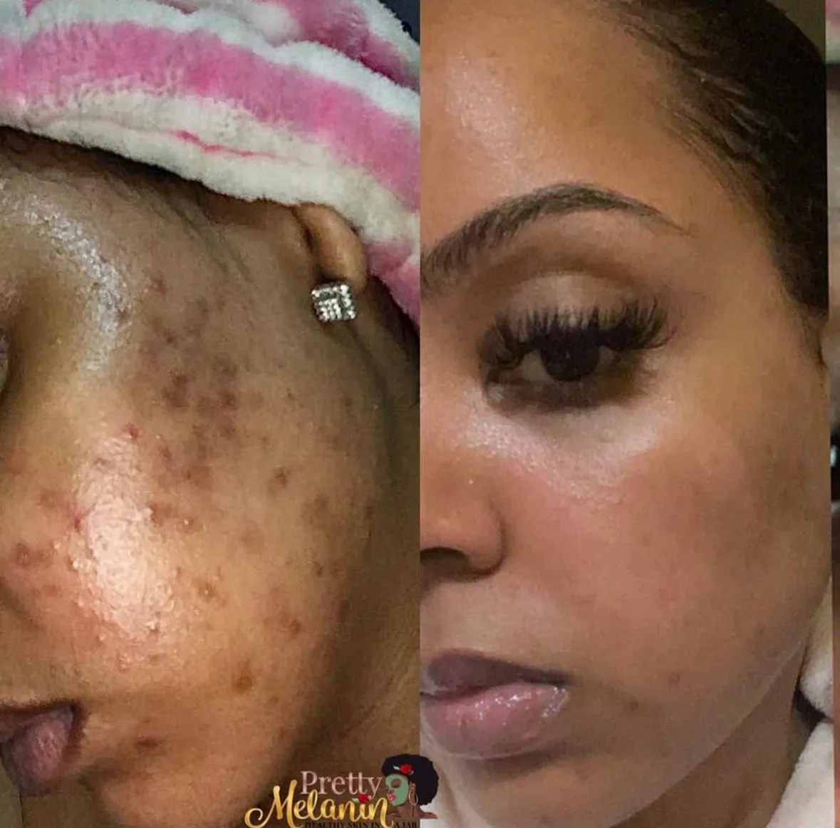 Face Serum (ALL DAY WEAR)