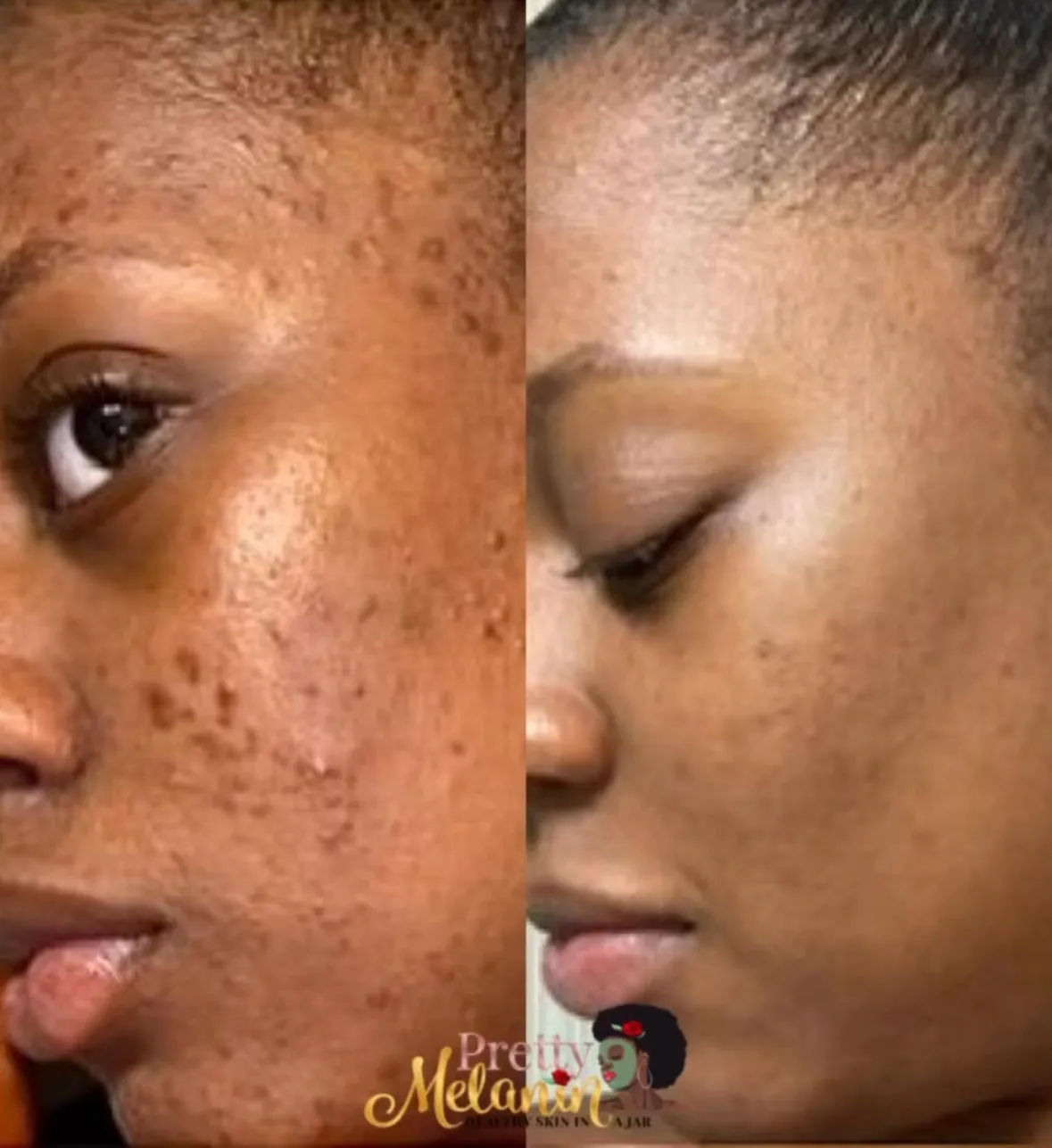 Face Serum (ALL DAY WEAR)